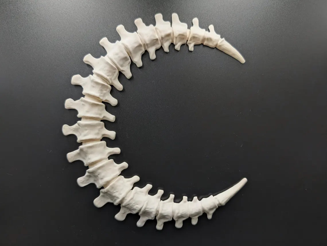 Several colour examples of the Spinal Moon displayed together